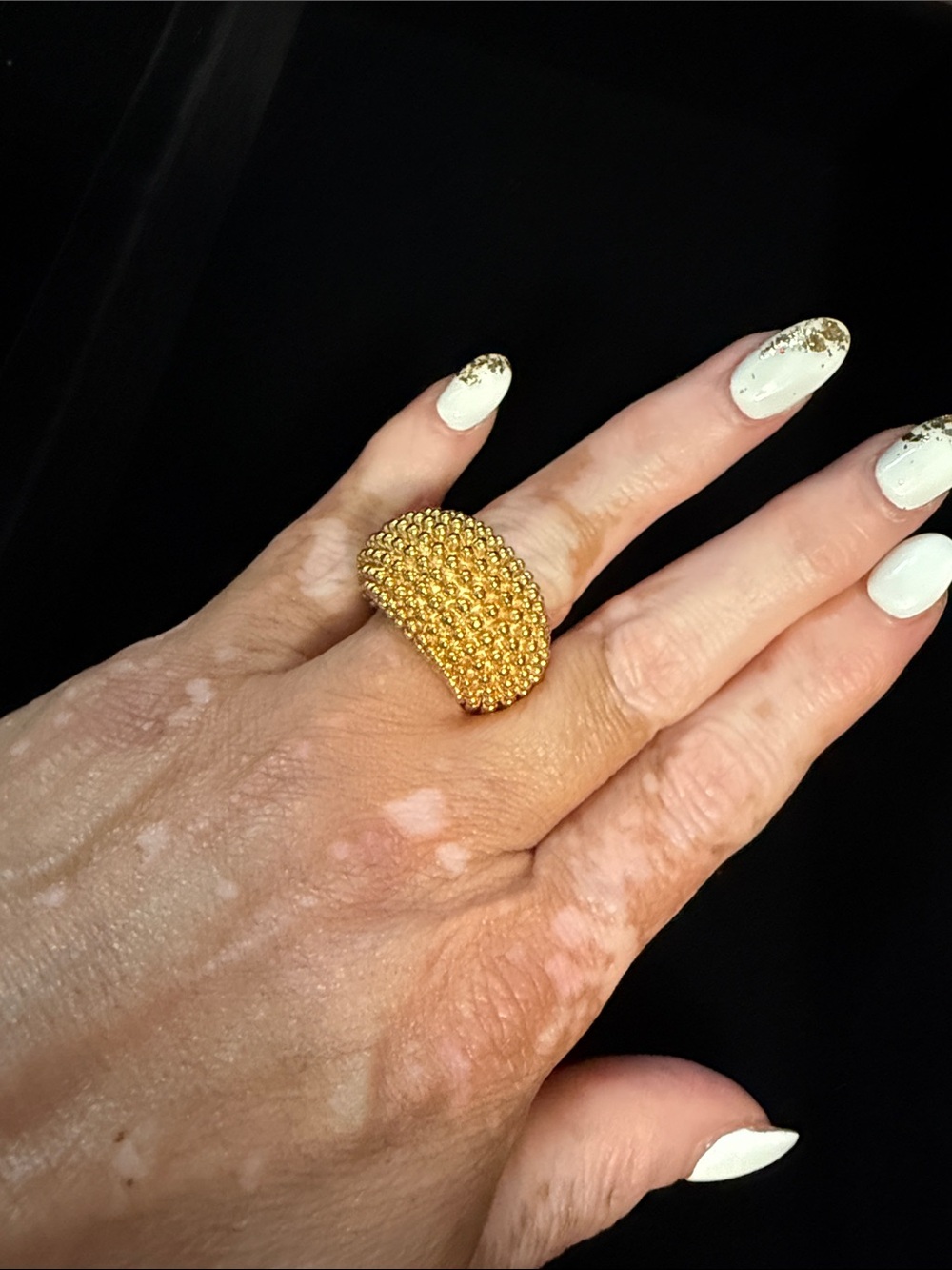 EPIC RING - Picture 13 of 14
